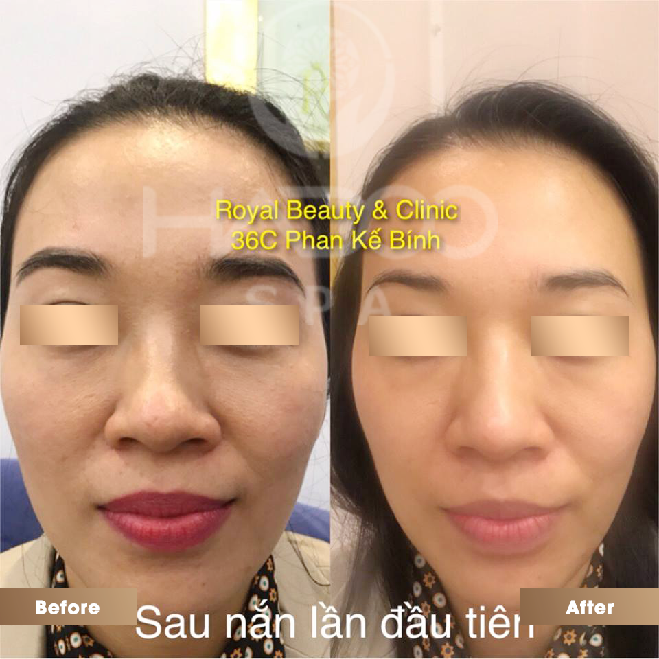 Anh 04